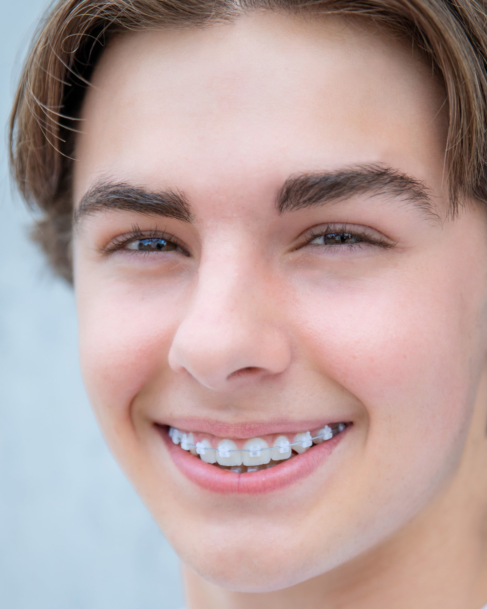 Norris-Clear-Bracket-Patient4