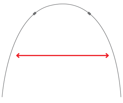 norris-extrabroad-archwire-diagram