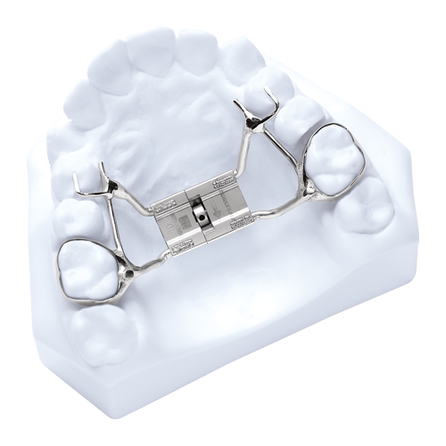 memory-screw-rpe Fixed Expanders
