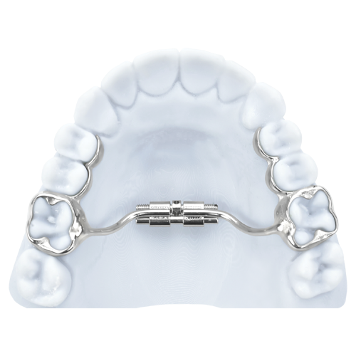 slimline-3D-metal-printed-bands