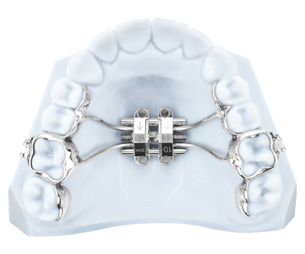 MARPE-3D-Bands Distalizers