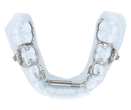 e-arch-3d-metal-printed-bands
