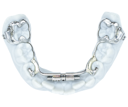 Lower-Slimline-3d-metal-printed-bands